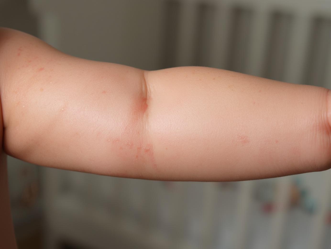 Hidden Hazards: The Unsettling Research About Allergens in Baby Skincare Products