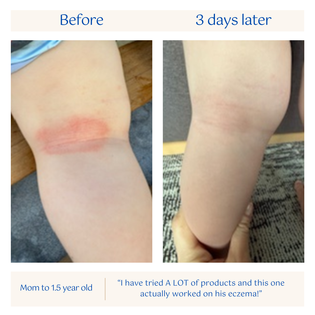 1.5_year_old_before_and_after.png